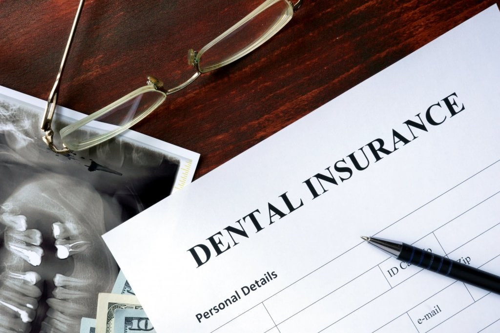 full coverage dental insurance Insurdinary